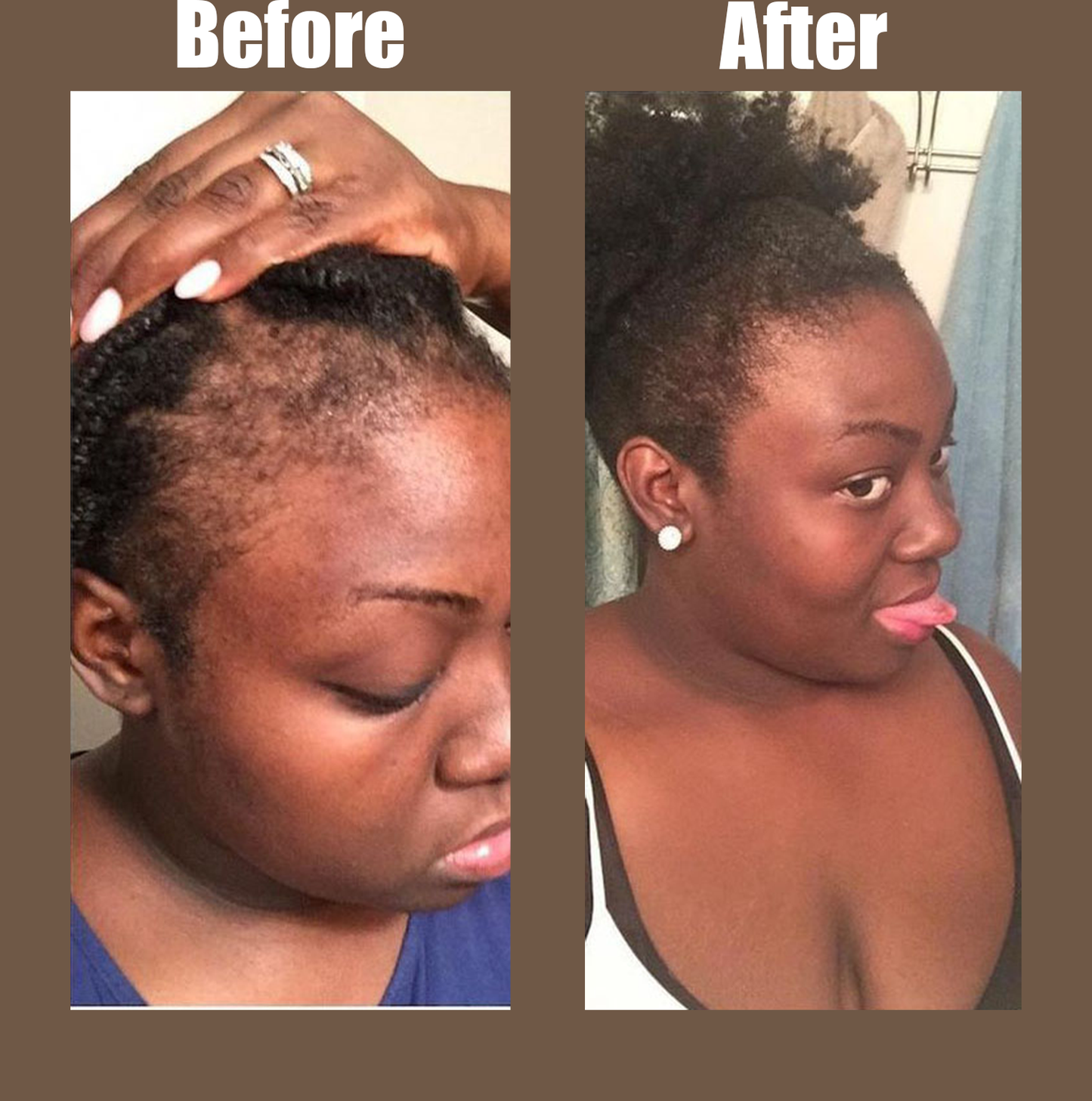 Batana Natural Hair Growth Oil