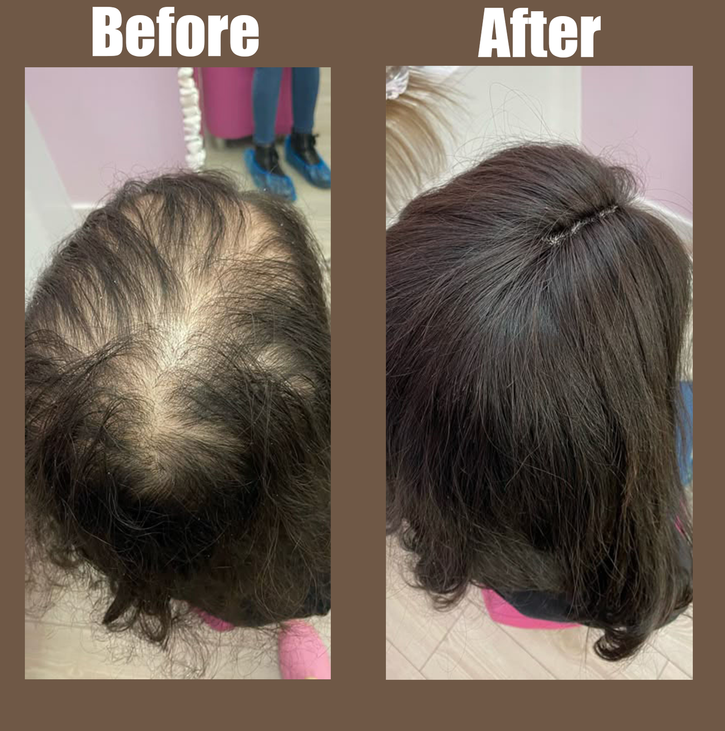 Batana Natural Hair Growth Oil